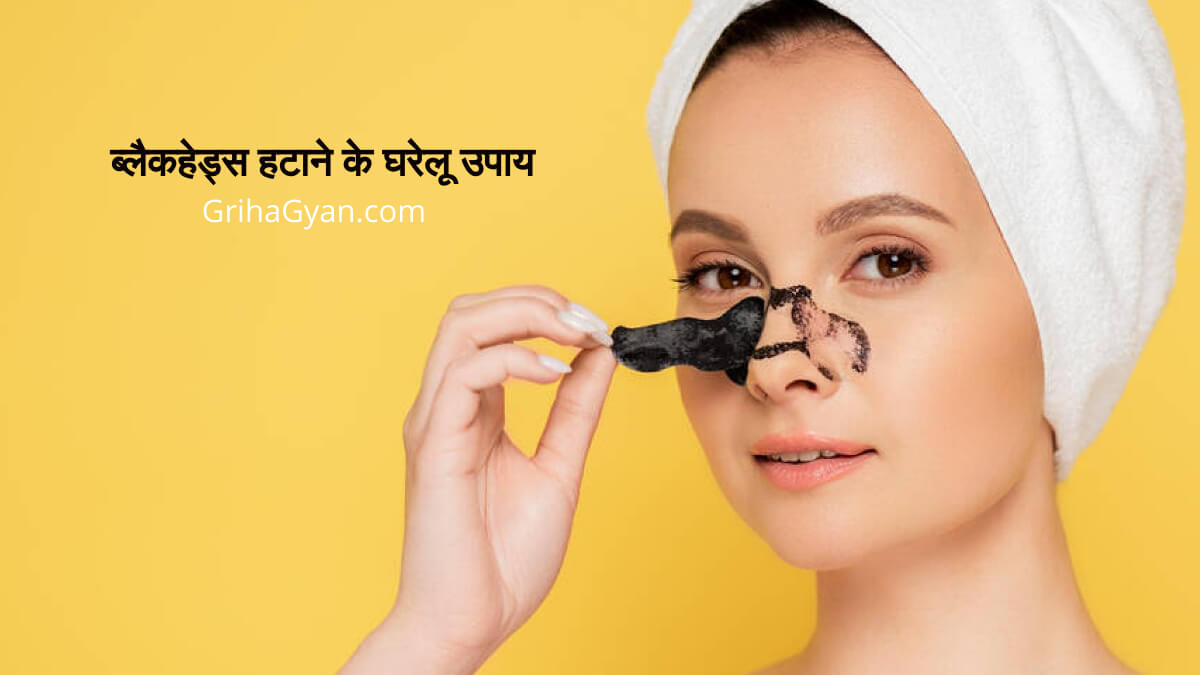 ब्लैकहेड्स हटाने के घरेलू उपाय (Blackheads Hatane Ke Gharelu Upay)