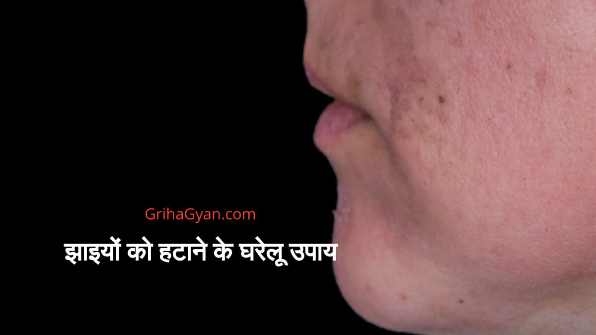 झाइयों को हटाने के घरेलू उपाय (Home Remedies For Skin Pigmentation)