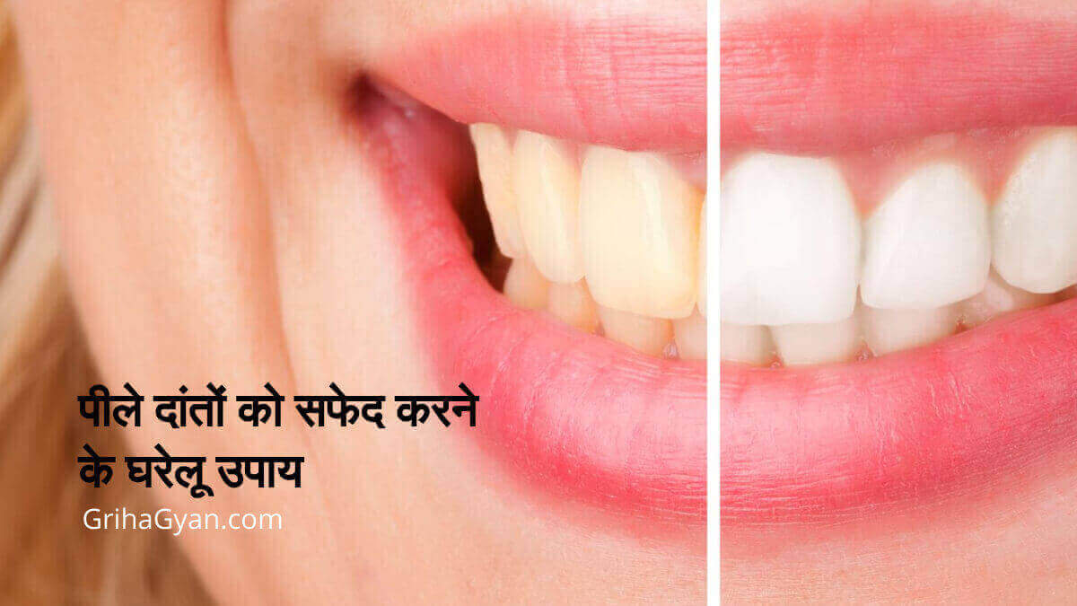 पीले दांतों को सफेद करने के घरेलू उपाय (Home Remedies For Teeth Whitening)